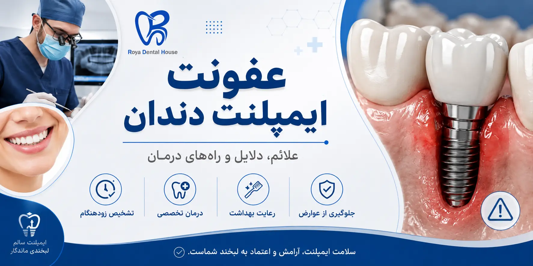 عفونت ایمپلنت دندان