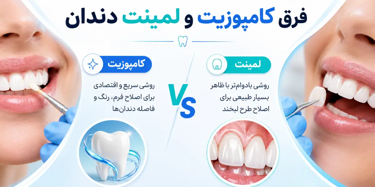 فرق لمینت و کامپوزیت دندان