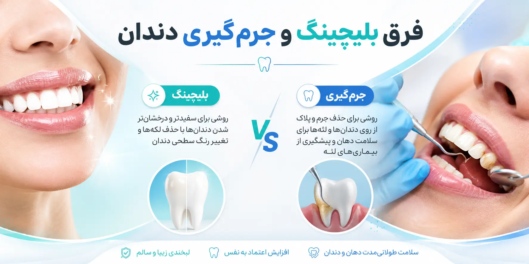 مقایسه عوارض بلیچینگ دندان با جرمگیری