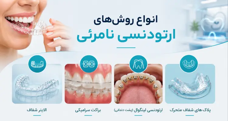 انواع روشهای ارتودنسی نامرئی