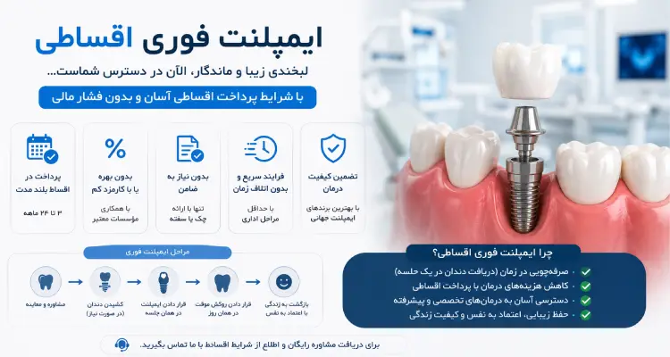 ایمپلنت فوری اقساطی