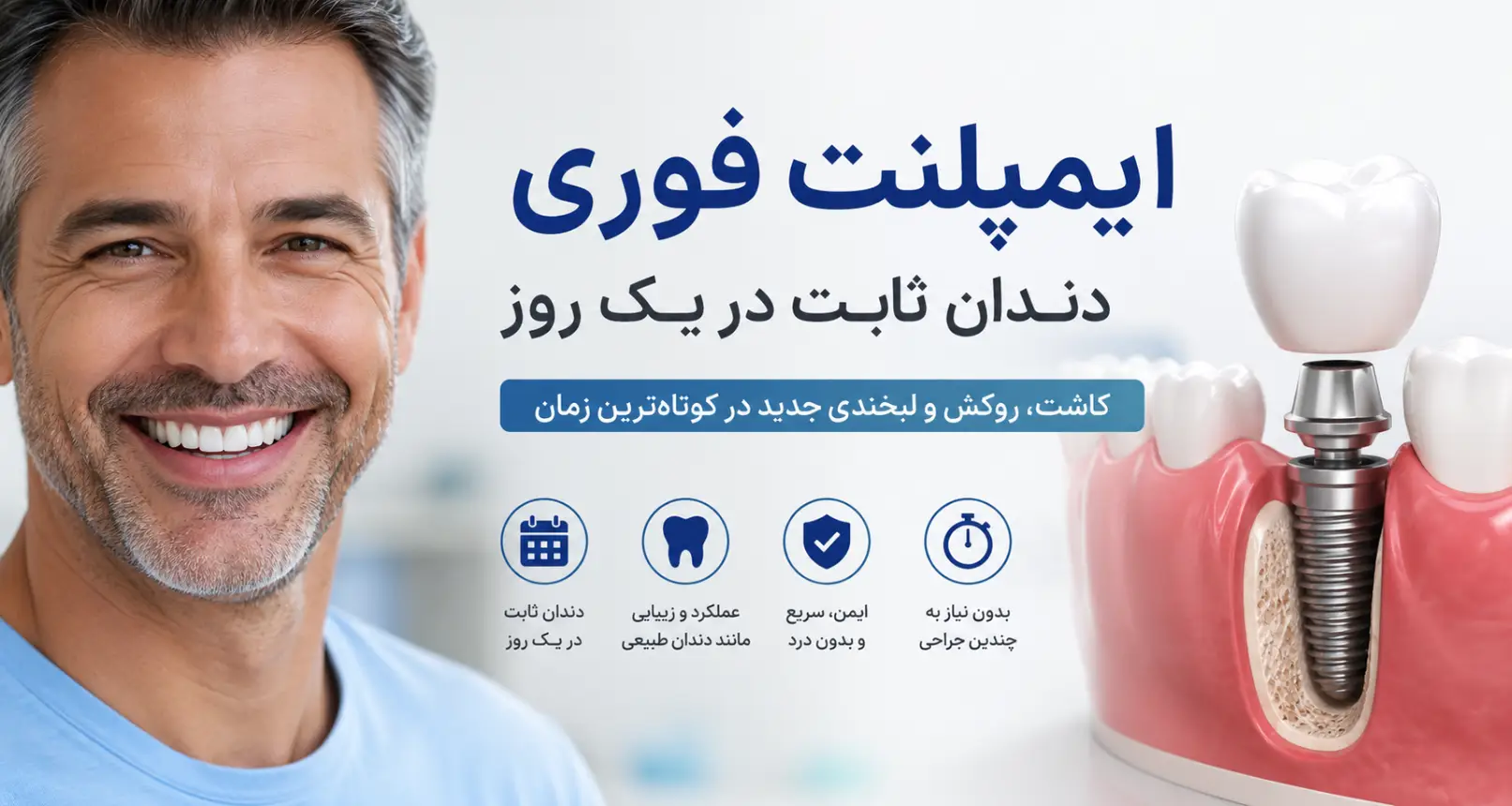 ایمپلنت فوری (ایمپلنت یک روزه)