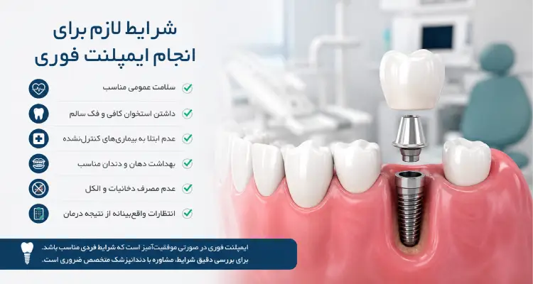 شرایط لازم برای انجام ایمپلنت فوری