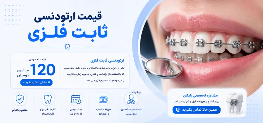 قیمت ارتودنسی ثابت فلزی