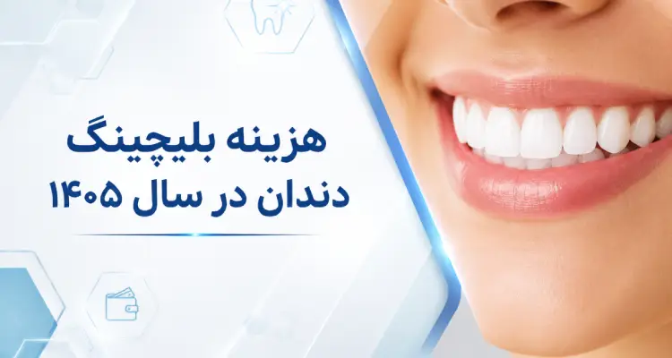 هزینه بلیچینگ دندان
