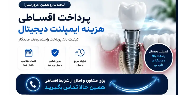 پرداخت اقساطی هزینه ایمپلنت دیجیتال