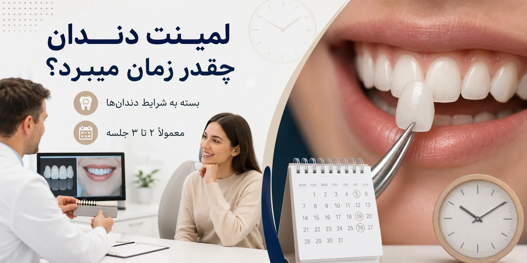 مراحل لمینت دندان از مشاوره تا نصب نهایی
